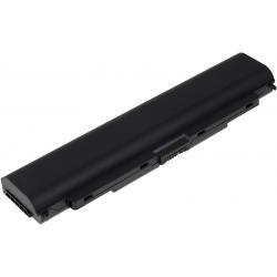 akumulátor pre Lenovo ThinkPad T440P 5200mAh