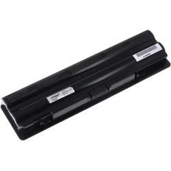 akumulátor pre Dell  XPS 17 5200mAh_3