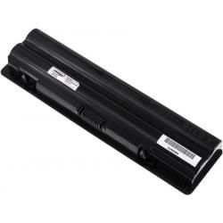 akumulátor pre Dell  XPS 17 5200mAh_4