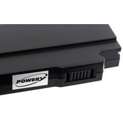 akumulátor pre Medion Typ 40029938(P)_2